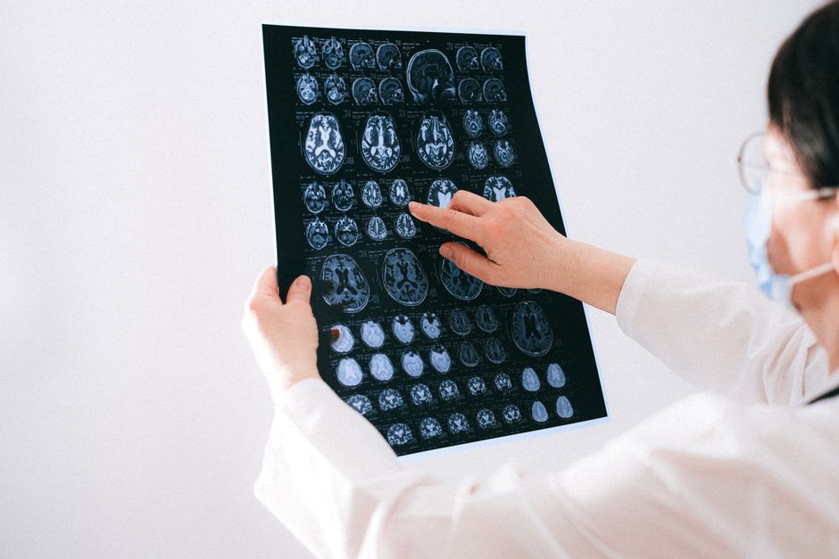Illustration related to brain health