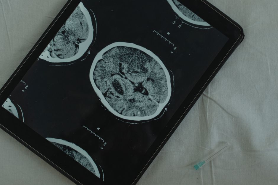 Photo related to How Does The Human Brain Complete The Process Of Listening A